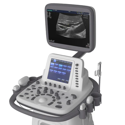 Ultrasound machine SonoScape S20Exp — Вид 4