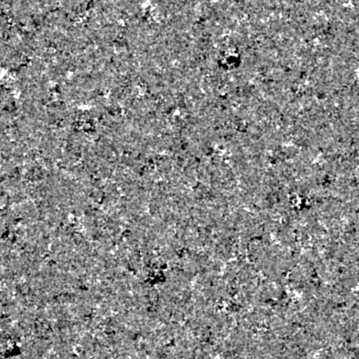 noise other 035 — Скачать