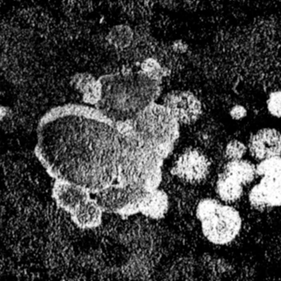 waterdamage rings dried stains 008 — Скачать